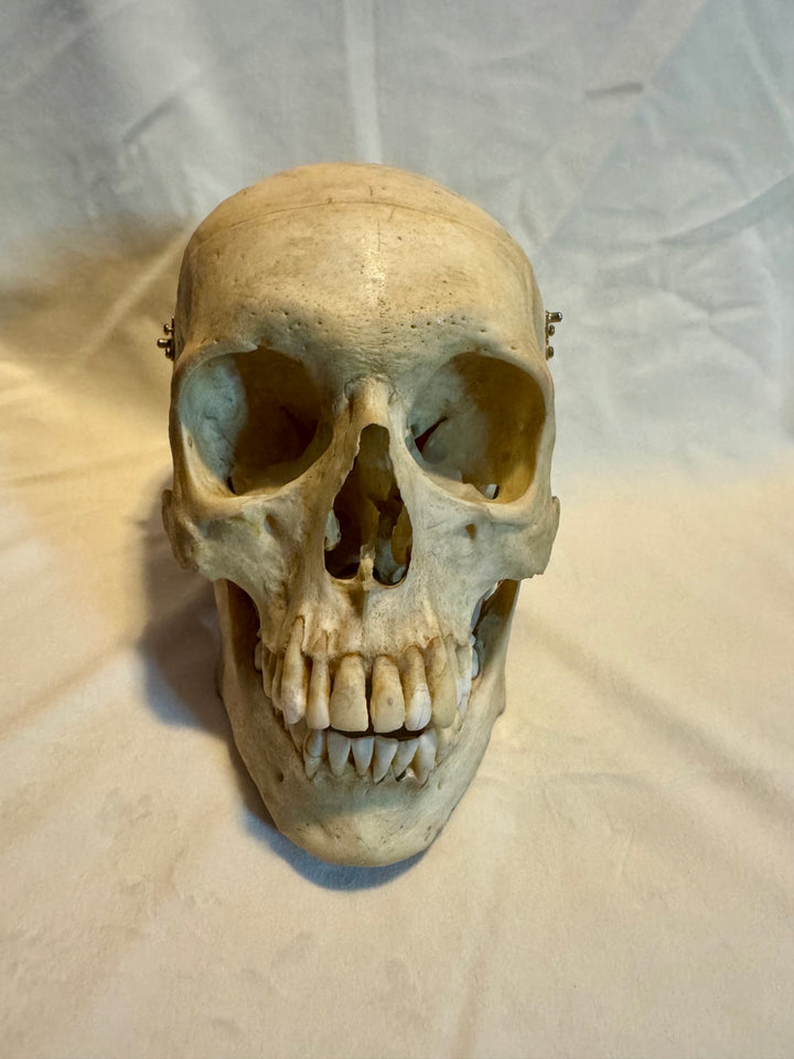 Human Skull in Complete and Exceptional Condition