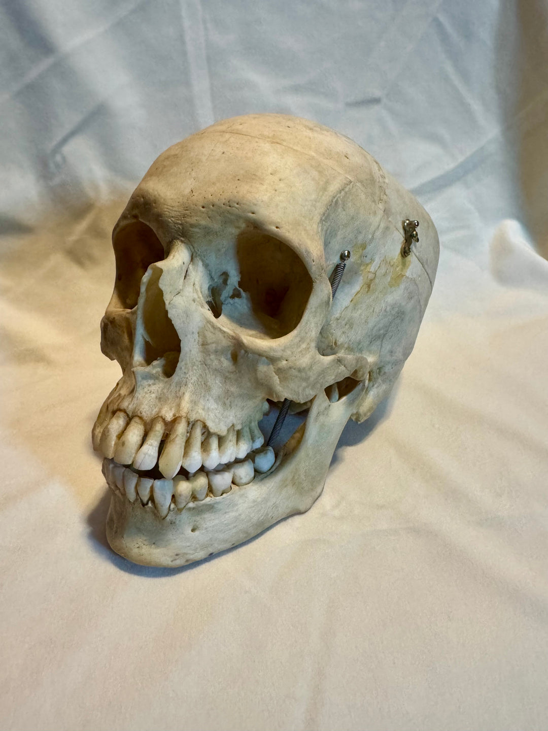 Human Skull in Complete and Exceptional Condition