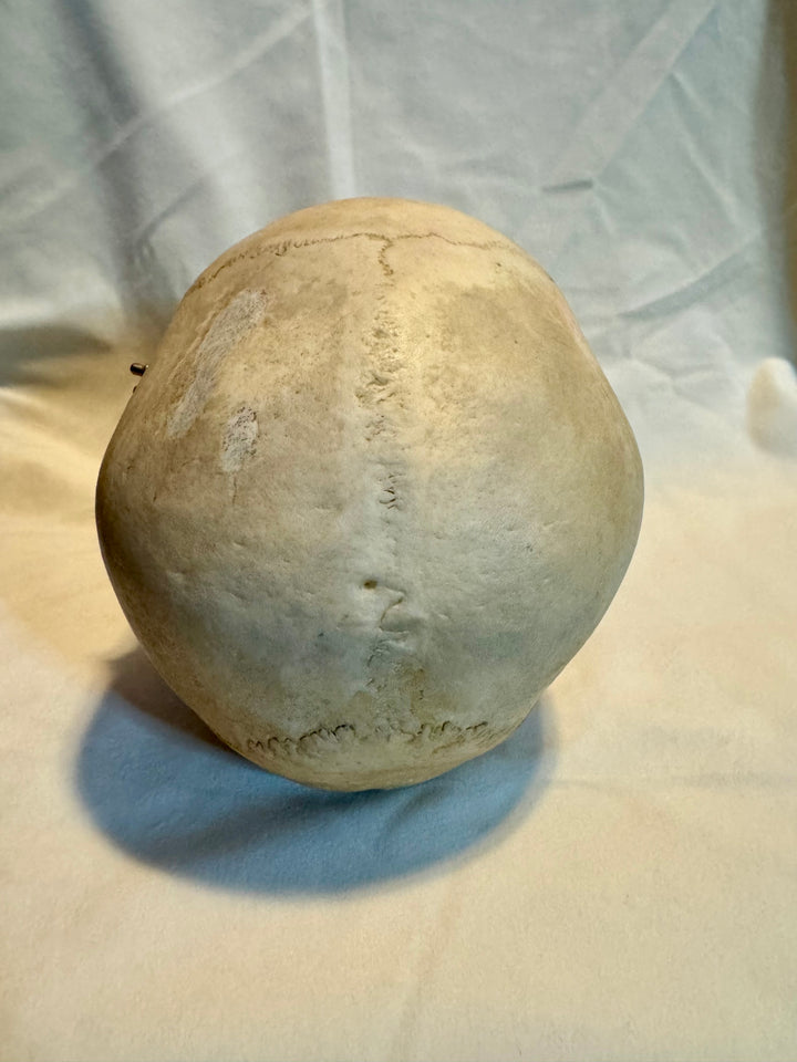 Human Skull in Complete and Exceptional Condition