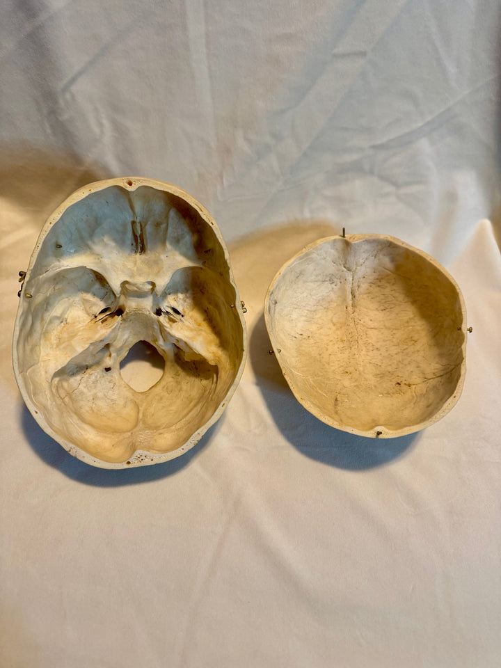 Human Skull in Complete and Exceptional Condition