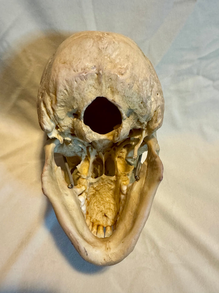 Human Skull in Complete and Exceptional Condition